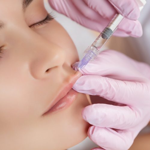 The doctor cosmetologist makes Lip augmentation procedure of a beautiful woman in a beauty salon.Cosmetology skin care.